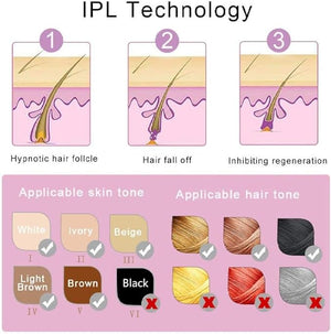 Mini Laser Hair Removal - MZ WorldMZ WorldMZ WorldMLH-N-GF-ZAMMini Laser Hair Removal