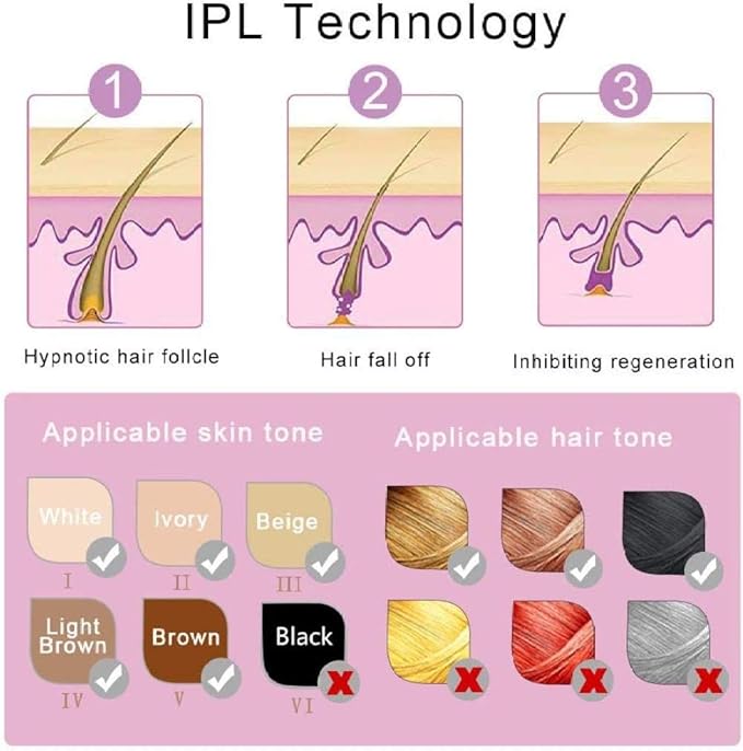 Mini Laser Hair Removal - MZ WorldMZ WorldMZ WorldMLH-N-GF-ZAMMini Laser Hair Removal